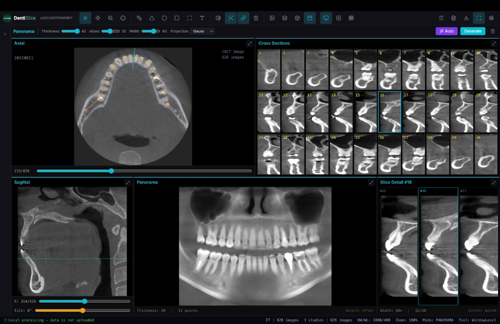 DentiSlice Panorama — dental arch with cross sections and panoramic X-ray
